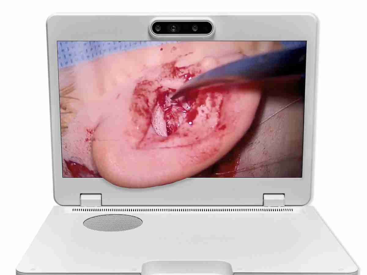 达擎之＂Heads-up 3D显微手术显示系统＂，，，，整合4K裸眼3D显示及眼球追踪系统，，具备快速追踪人眼移动位置功能，，，，减轻医师长时间维持固定姿势的负担，，，让医师能有更宽广清晰的3D立体视野及更舒适的姿势来执行手术。。